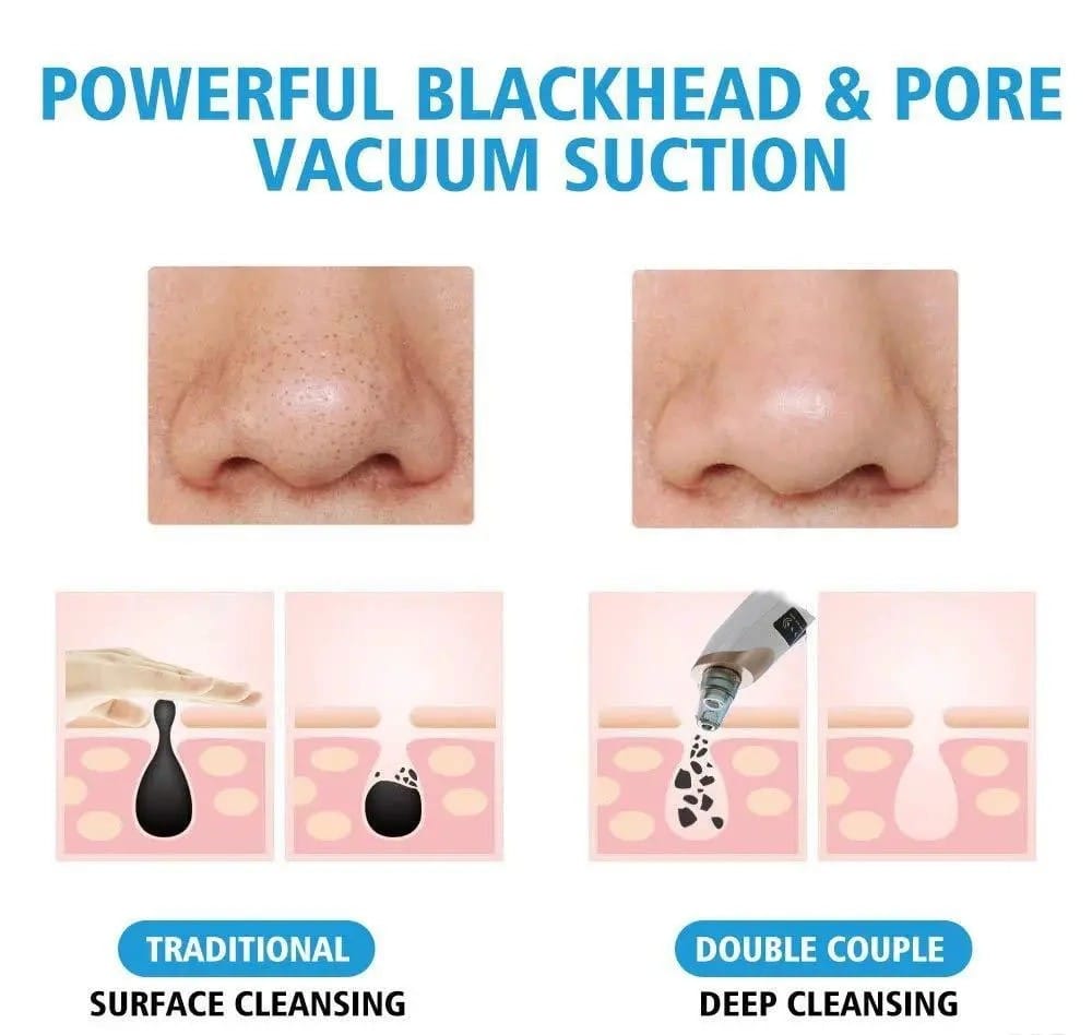 BlackHead removal machine ( Multifunctional Cleaning Instruments )