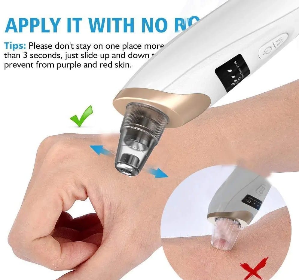 BlackHead removal machine ( Multifunctional Cleaning Instruments )